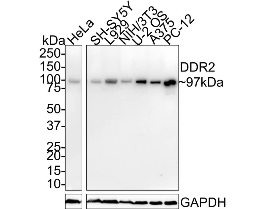 Western Blot: DDR2 Antibody (JE31-45) [NBP3-32260] - Western blot analysis of DDR2 on different lysates with Rabbit anti-DDR2 antibody (NBP3-32260) at 1/1,000 dilution. Lane 1: HeLa cell lysate (40 ug/Lane) Lane 2: SH-SY5Y cell lysate (40 ug/Lane) Lane 3: L929 cell lysate (40 ug/Lane) Lane 4: NIH/3T3 cell lysate (40 ug/Lane) Lane 5: U-2 OS cell lysate (15 ug/Lane) Lane 6: A375 cell lysate (15 ug/Lane) Lane 7: PC-12 cell lysate (10 ug/Lane) Predicted band size: 97 kDa Observed band size: 97 kDa Exposure time: 2 minutes; 4-20% SDS-PAGE gel. Proteins were transferred to a PVDF membrane and blocked with 5% NFDM/TBST for 1 hour at room temperature. The primary antibody (NBP3-32260) at 1/1,000 dilution was used in 5% NFDM/TBST at room temperature for 2 hours. Goat Anti-Rabbit IgG - HRP Secondary Antibody at 1:100,000 dilution was used for 1 hour at room temperature.