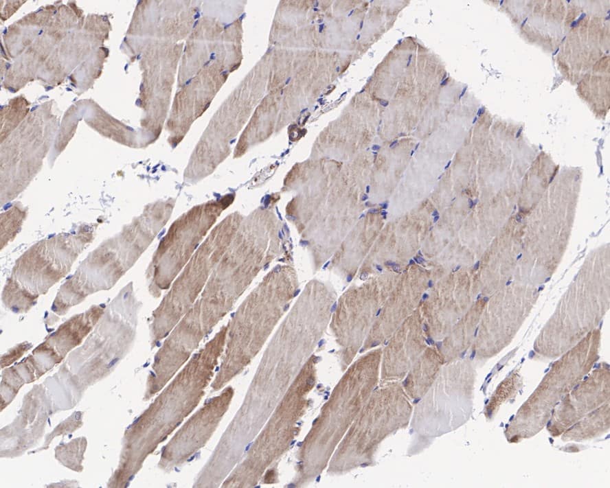 Immunohistochemistry: DDR2 Antibody (JE31-45) [NBP3-32260] - Immunohistochemical analysis of paraffin-embedded rat skeletal muscle tissue with Rabbit anti-DDR2 antibody (NBP3-32260) at 1/200 dilution. The section was pre-treated using heat mediated antigen retrieval with Tris-EDTA buffer (pH 9.0) for 20 minutes. The tissues were blocked in 1% BSA for 20 minutes at room temperature, washed with ddH2O and PBS, and then probed with the primary antibody (NBP3-32260) at 1/200 dilution for 1 hour at room temperature. The detection was performed using an HRP conjugated compact polymer system. DAB was used as the chromogen. Tissues were counterstained with hematoxylin and mounted with DPX.