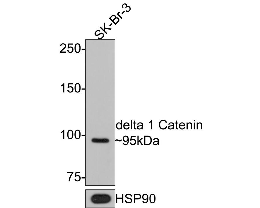 Western blot analysis of  SK-Br-3 cell lysates with NBP3-32263 at 1/1,000 dilution. Lysates/proteins at 10 µg/Lane. Predicted band size: 108 kDa Observed band size: 95 kDa Exposure time: 1 minute; 6% SDS-PAGE gel. Proteins were transferred to a PVDF membrane and blocked with 5% NFDM/TBST for 1 hour at room temperature. NBP3-32263 at 1/1,000 dilution was used in 5% NFDM/TBST at room temperature for 2 hours. Goat Anti-Rabbit IgG [HRP] Secondary Antibody at 1:300,000 dilution was used for 1 hour at room temperature.