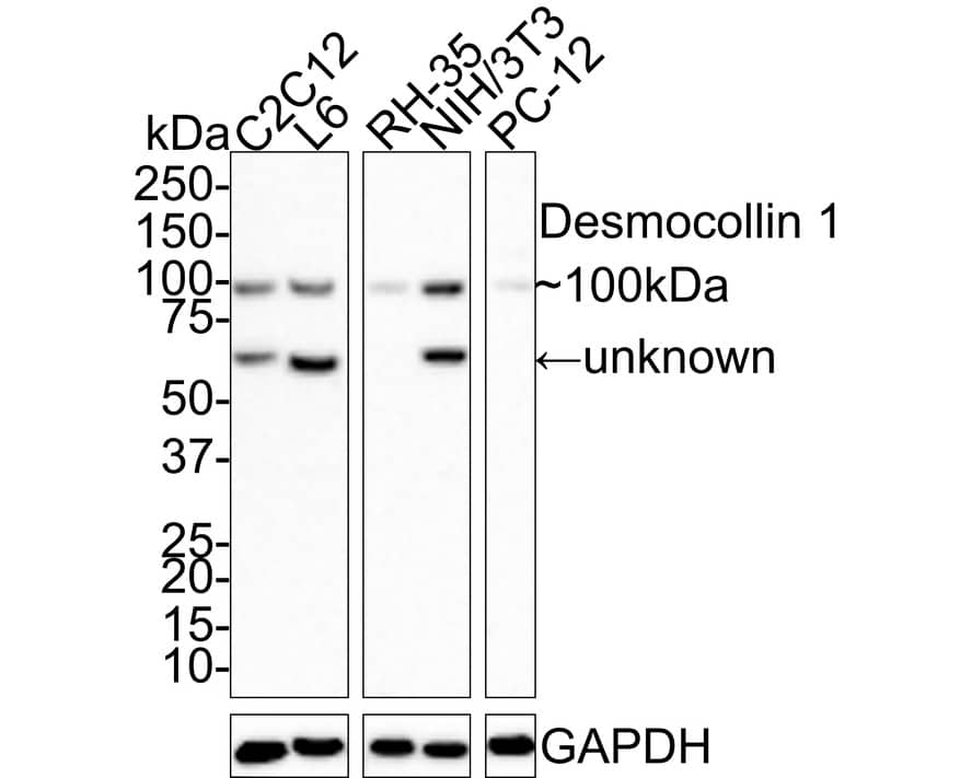 Western Blot: Desmocollin-1 Antibody (JE66-57) [NBP3-32264] - Western blot analysis of Desmocollin-1 on different lysates with Rabbit anti-Desmocollin-1 antibody (NBP3-32264) at 1/1,000 dilution. Lane 1: C2C12 cell lysate Lane 2: L6 cell lysate Lane 3: RH-35 cell lysate Lane 4: NIH/3T3 cell lysate Lane 5: PC-12 cell lysate Lysates/proteins at 20 ug/Lane. Predicted band size: 100 kDa Observed band size: 100/60kDa Exposure time: 2 minutes; 4-20% SDS-PAGE gel. Proteins were transferred to a PVDF membrane and blocked with 5% NFDM/TBST for 1 hour at room temperature. The primary antibody (NBP3-32264) at 1/1,000 dilution was used in 5% NFDM/TBST at room temperature for 2 hours. Goat Anti-Rabbit IgG - HRP Secondary Antibody at 1:100,000 dilution was used for 1 hour at room temperature.