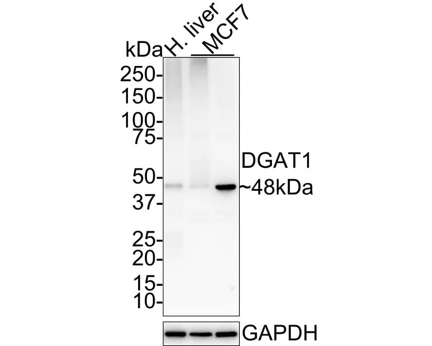 Western blot analysis on different lysates with NBP3-32265 at 1/1,000 dilution. Lane 1: Human liver tissue lysate Lane 2: MCF7 cell lysate (RIPA lysis) Lane 3: MCF7 cell lysate (hot lysis) Lysates/proteins at 15 µg/Lane. Predicted band size: 55 kDa Observed band size: 48 kDa Exposure time: 2 minutes; 4-20% SDS-PAGE gel. Proteins were transferred to a PVDF membrane and blocked with 5% NFDM/TBST for 1 hour at room temperature. NBP3-32265 at 1/1,000 dilution was used in 5% NFDM/TBST at 4℃ overnight. Goat Anti-Rabbit IgG [HRP] Secondary Antibody at 1:100,000 dilution was used for 1 hour at room temperature.