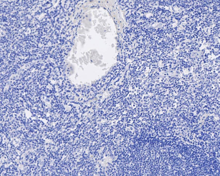 Immunohistochemistry: Digoxigenin Antibody (PSH04-39) [NBP3-32266] - Immunohistochemical analysis of paraffin-embedded human tonsil tissue (negative) with Rabbit anti-Digoxigenin antibody (NBP3-32266) at 1/1,000 dilution. The section was pre-treated using heat mediated antigen retrieval with Tris-EDTA buffer (pH 9.0) for 20 minutes. The tissues were blocked in 1% BSA for 20 minutes at room temperature, washed with ddH2O and PBS, and then probed with the primary antibody (NBP3-32266) at 1/1,000 dilution for 1 hour at room temperature. The detection was performed using an HRP conjugated compact polymer system. DAB was used as the chromogen. Tissues were counterstained with hematoxylin and mounted with DPX.