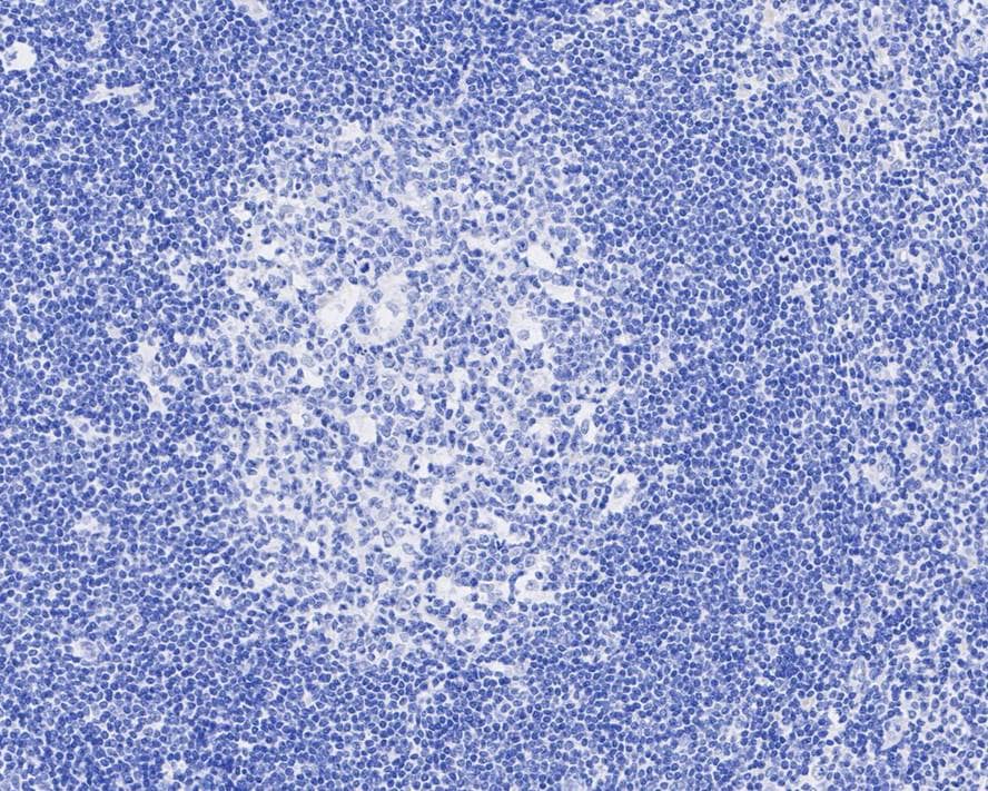 Immunohistochemistry: Digoxin Antibody (PSH04-40) [NBP3-32267] - Immunohistochemical analysis of paraffin-embedded human tonsil tissue (negative) with Rabbit anti-Digoxin antibody (NBP3-32267) at 1/1,000 dilution. The section was pre-treated using heat mediated antigen retrieval with Tris-EDTA buffer (pH 9.0) for 20 minutes. The tissues were blocked in 1% BSA for 20 minutes at room temperature, washed with ddH2O and PBS, and then probed with the primary antibody (NBP3-32267) at 1/1,000 dilution for 1 hour at room temperature. The detection was performed using an HRP conjugated compact polymer system. DAB was used as the chromogen. Tissues were counterstained with hematoxylin and mounted with DPX.