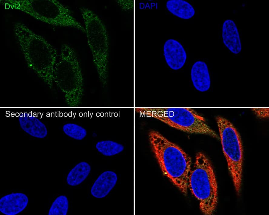 Immunocytochemistry/ Immunofluorescence: Dishevelled-2 Antibody (PSH04-07) [NBP3-32269] - Immunocytochemistry analysis of HeLa cells labeling Dishevelled-2 with Rabbit anti-Dishevelled-2 antibody (NBP3-32269) at 1/100 dilution. Cells were fixed in 4% paraformaldehyde for 20 minutes at room temperature, permeabilized with 0.1% Triton X-100 in PBS for 5 minutes at room temperature, then blocked with 1% BSA in 10% negative goat serum for 1 hour at room temperature. Cells were then incubated with Rabbit anti-Dishevelled-2 antibody (NBP3-32269) at 1/100 dilution in 1% BSA in PBST overnight at 4 ℃. Goat Anti-Rabbit IgG H&L (iFluor™ 488) was used as the secondary antibody at 1/1,000 dilution. PBS instead of the primary antibody was used as the secondary antibody only control. Nuclear DNA was labelled in blue with DAPI. Beta tubulin (red) was stained at 1/100 dilution overnight at +4℃. Goat Anti-Mouse IgG H&L (iFluor™ 594) was used as the secondary antibody at 1/1,000 dilution.