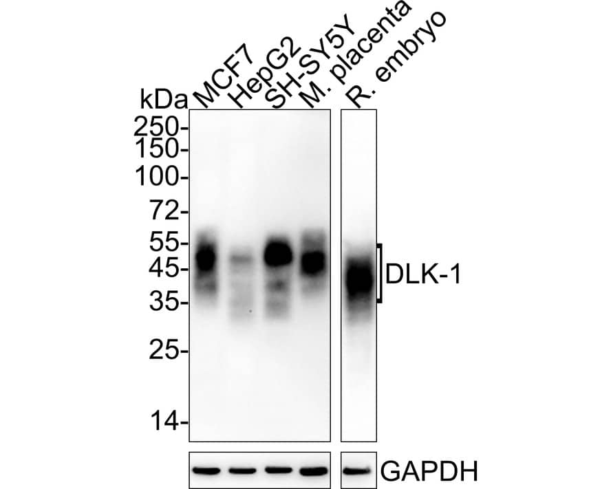 Western Blot: Pref-1/DLK1/FA1 Antibody (PSH04-76) [NBP3-32270] - Western blot analysis of Pref-1/DLK1/FA1 on different lysates with Rabbit anti-Pref-1/DLK1/FA1 antibody (NBP3-32270) at 1/1,000 dilution. Lane 1: MCF7 cell lysate (20 ug/Lane) Lane 2: HepG2 cell lysate (20 ug/Lane) Lane 3: SH-SY5Y cell lysate (20 ug/Lane) Lane 4: Mouse placenta tissue lysate (70  heat) (40 ug/Lane) Lane 5: Rat embryo tissue lysate (40 ug/Lane) Predicted band size: 41 kDa Observed band size: 40-50kDa Exposure time: Lane 1-4: 2 minutes; Lane 5: 27 seconds; ECL; 4-20% SDS-PAGE gel. Proteins were transferred to a PVDF membrane and blocked with 5% NFDM/TBST for 1 hour at room temperature. The primary antibody (NBP3-32270) at 1/1,000 dilution was used in 5% NFDM/TBST at 4C overnight. Goat Anti-Rabbit IgG - HRP Secondary Antibody at 1/50,000 dilution was used for 1 hour at room temperature.