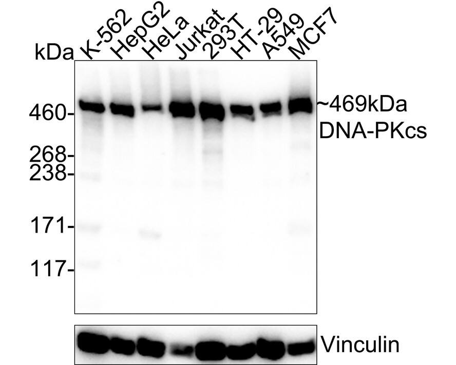 Western blot analysis on different lysates with NBP3-32272 at 1/2,000 dilution. Lane 1: K-562 cell lysate Lane 2: HepG2 cell lysate Lane 3: HeLa cell lysate Lane 4: Jurkat cell lysate Lane 5: 293T cell lysate Lane 6: HT-29 cell lysate Lane 7: A549 cell lysate Lane 8: MCF7 cell lysate Lysates/proteins at 20 µg/Lane. Predicted band size: 469 kDa Observed band size: 469 kDa Exposure time: 23 seconds; 3-8% SDS-PAGE gel. Proteins were transferred to a PVDF membrane and blocked with 5% NFDM/TBST for 1 hour at room temperature. NBP3-32272 at 1/2,000 dilution was used in 5% NFDM/TBST at 4℃ overnight. Goat anti-Mouse IgG [HRP] at 1/50,000 dilution was used for 1 hour at room temperature.
