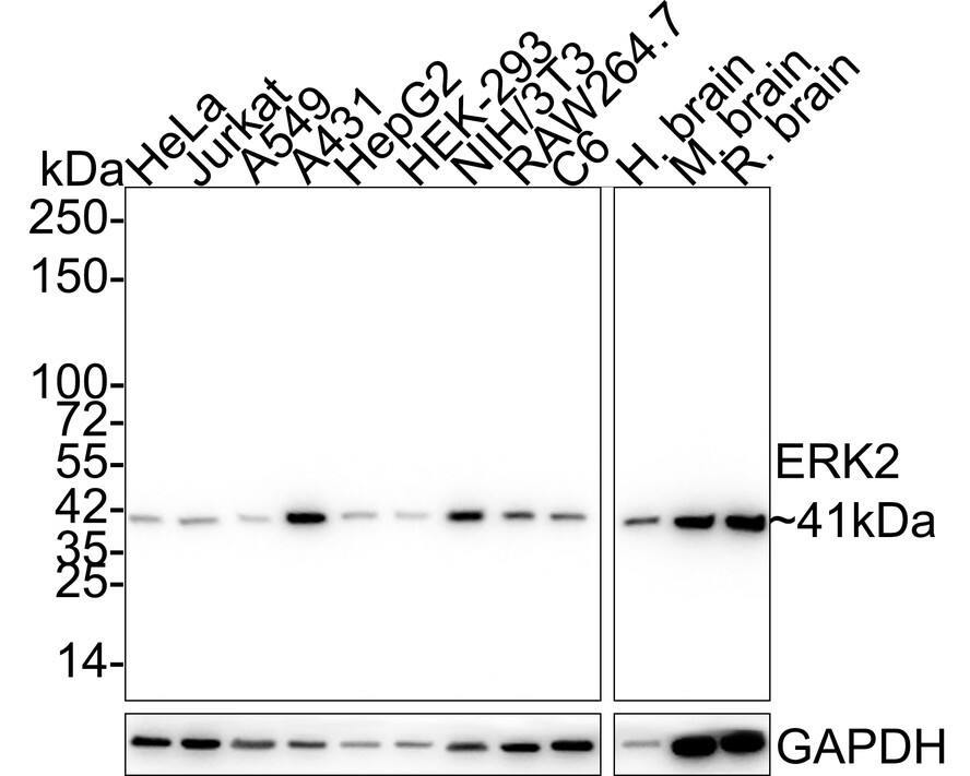 Western blot analysis on different lysates with NBP3-32273 at 1/1,000 dilution. Lane 1: HeLa cell lysate (20 µg/Lane) Lane 2: Jurkat cell lysate (20 µg/Lane) Lane 3: A549 cell lysate (20 µg/Lane) Lane 4: A431 cell lysate (20 µg/Lane) Lane 5: HepG2 cell lysate (20 µg/Lane) Lane 6: HEK-293 cell lysate (20 µg/Lane) Lane 7: NIH/3T3 cell lysate (20 µg/Lane) Lane 8: RAW264.7 cell lysate (20 µg/Lane) Lane 9: C6 cell lysate (20 µg/Lane) Lane 10: Human brain tissue lysate (40 µg/Lane) Lane 11: Mouse brain tissue lysate (40 µg/Lane) Lane 12: Rat brain tissue lysate (40 µg/Lane) Predicted band size: 41 kDa Observed band size: 41 kDa Exposure time: 43 seconds;  4-20% SDS-PAGE gel. Proteins were transferred to a PVDF membrane and blocked with 5% NFDM/TBST for 1 hour at room temperature. NBP3-32273 at 1/1,000 dilution was used in 5% NFDM/TBST at 4℃ overnight. Alpaca Anti-Mouse IgG [HRP] Secondary Antibody at 1/5,000 dilution was used for 1 hour at room temperature.