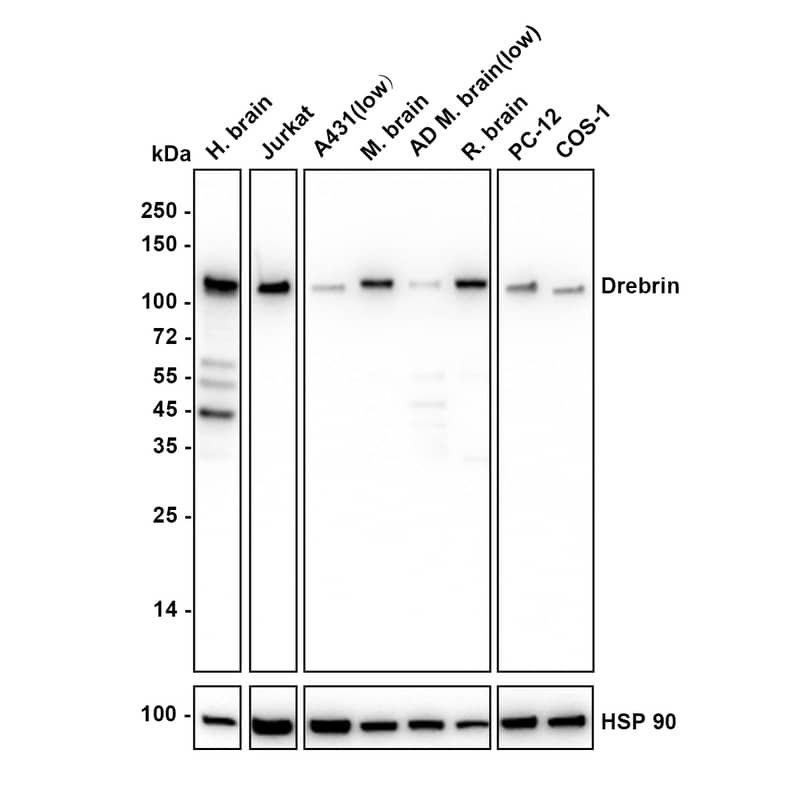 Western blot analysis on different lysates with NBP3-32279 at 1/1,000 dilution. Lane 1: Human brain tissue lysate Lane 2: Jurkat cell lysate Lane 3: A431 cell lysate (low expression) Lane 4: Mouse brain tissue lysate Lane 5: AD Mouse brain tissue lysate (low expression) Lane 6: Rat brain tissue lysate Lane 7: PC-12 cell lysate Lane 8: COS-1 cell lysate Lysates/proteins at 20 µg/Lane. Exposure time: 5 seconds Blocking: 5% NFDM/TBST, 1 hour at room temperature Primary antibody: NBP3-32279, 1/1,000 in 5% NFDM/TBST, overnight at 4 ℃ Secondary antibody: Goat Anti-Rabbit IgG [HRP] Secondary Antibody, 1/50,000 in 5% NFDM/TBST, 1 hour at room temperature Predicted band size: 71 kDa Observed band size: 110 kDa
