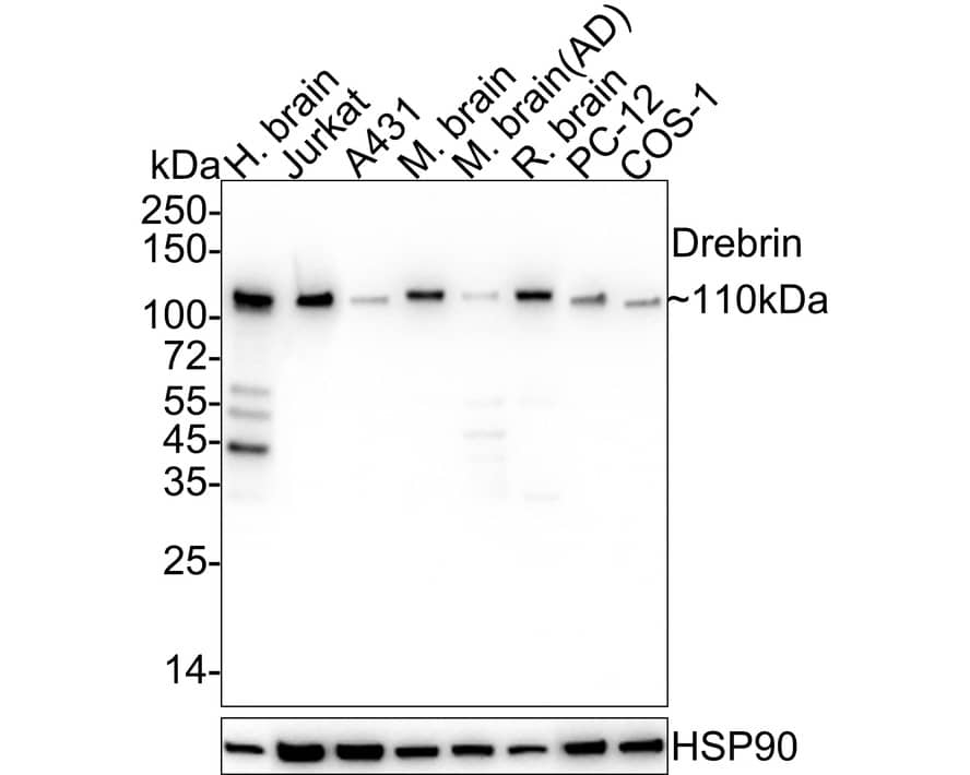 Western Blot: Drebrin 1 Antibody (JE30-20) [NBP3-32279] - Western blot analysis of Drebrin 1 on different lysates with Rabbit anti-Drebrin 1 antibody (NBP3-32279) at 1/1,000 dilution. Lane 1: Human brain tissue lysate Lane 2: Jurkat cell lysate Lane 3: A431 cell lysate (low expression) Lane 4: Mouse brain tissue lysate Lane 5: AD Mouse brain tissue lysate (low expression) Lane 6: Rat brain tissue lysate Lane 7: PC-12 cell lysate Lane 8: COS-1 cell lysate Lysates/proteins at 20 ug/Lane. Predicted band size: 71 kDa Observed band size: 110 kDa Exposure time: 5 seconds; 4-20% SDS-PAGE gel. Proteins were transferred to a PVDF membrane and blocked with 5% NFDM/TBST for 1 hour at room temperature. The primary antibody (NBP3-32279) at 1/1,000 dilution was used in 5% NFDM/TBST at 4C overnight. Goat Anti-Rabbit IgG - HRP Secondary Antibody at 1/50,000 dilution was used for 1 hour at room temperature.