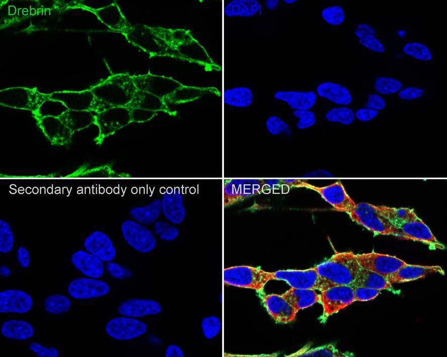 Immunocytochemistry/ Immunofluorescence: Drebrin 1 Antibody (JE30-20) [NBP3-32279] - Immunocytochemistry analysis of SH-SY5Y cells labeling Drebrin 1 with Rabbit anti-Drebrin 1 1 antibody (NBP3-32279) at 1/250 dilution. Cells were fixed in 4% paraformaldehyde for 20 minutes at room temperature, permeabilized with 0.1% Triton X-100 in PBS for 5 minutes at room temperature, then blocked with 1% BSA in 10% negative goat serum for 1 hour at room temperature. Cells were then incubated with Rabbit anti-Drebrin 1 antibody (NBP3-32279) at 1/250 dilution in 1% BSA in PBST overnight at 4 ℃. Goat Anti-Rabbit IgG H&L (iFluor™ 488) was used as the secondary antibody at 1/1,000 dilution. PBS instead of the primary antibody was used as the secondary antibody only control. Nuclear DNA was labelled in blue with DAPI. Beta tubulin (red) was stained at 1/100 dilution overnight at +4℃. Goat Anti-Mouse IgG H&L (iFluor™ 594) was used as the secondary antibody at 1/1,000 dilution.