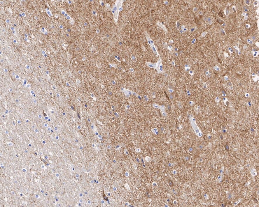 Immunohistochemistry: Drebrin 1 Antibody (JE30-20) [NBP3-32279] - Immunohistochemical analysis of paraffin-embedded human brain tissue with Rabbit anti-Drebrin 1 antibody (NBP3-32279) at 1/1,000 dilution. The section was pre-treated using heat mediated antigen retrieval with Tris-EDTA buffer (pH 9.0) for 20 minutes. The tissues were blocked in 1% BSA for 20 minutes at room temperature, washed with ddH2O and PBS, and then probed with the primary antibody (NBP3-32279) at 1/1,000 dilution for 1 hour at room temperature. The detection was performed using an HRP conjugated compact polymer system. DAB was used as the chromogen. Tissues were counterstained with hematoxylin and mounted with DPX.
