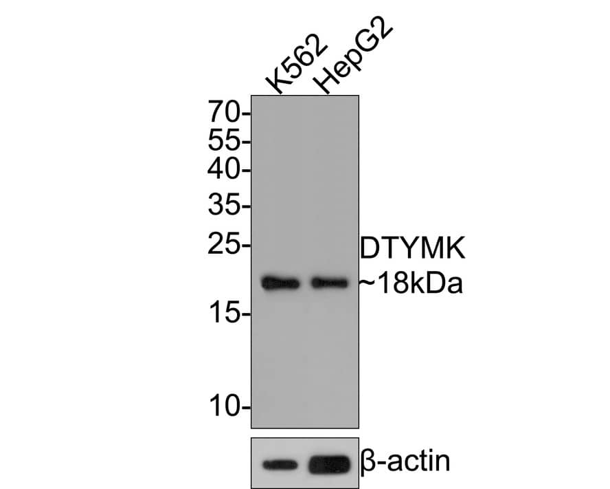 Western Blot: DTYMK Antibody (JE64-08) [NBP3-32280] - Western blot analysis of DTYMK on different lysates with Rabbit anti-DTYMK antibody (NBP3-32280) at 1/500 dilution. Lane 1: K562 cell lysate Lane 2: HepG2 cell lysate Lysates/proteins at 10 ug/Lane. Predicted band size: 24 kDa Observed band size: 18 kDa Exposure time: 2 minutes; 15% SDS-PAGE gel. Proteins were transferred to a PVDF membrane and blocked with 5% NFDM/TBST for 1 hour at room temperature. The primary antibody (NBP3-32280) at 1/500 dilution was used in 5% NFDM/TBST at room temperature for 2 hours. Goat Anti-Rabbit IgG - HRP Secondary Antibody at 1:300,000 dilution was used for 1 hour at room temperature.