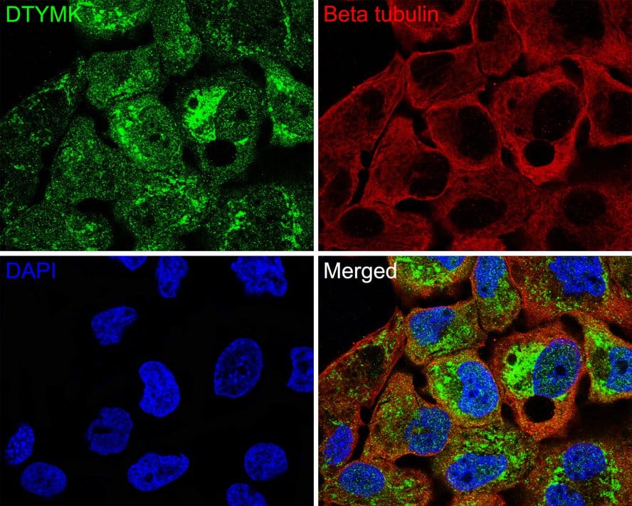 Immunocytochemistry/ Immunofluorescence: DTYMK Antibody (JE64-08) [NBP3-32280] - Immunocytochemistry analysis of NCI-H441 cells labeling DTYMK with Rabbit anti-DTYMK antibody (NBP3-32280) at 1/50 dilution. Cells were fixed in 4% paraformaldehyde for 10 minutes at 37 ℃, permeabilized with 0.05% Triton X-100 in PBS for 20 minutes, and then blocked with 2% negative goat serum for 30 minutes at room temperature. Cells were then incubated with Rabbit anti-DTYMK antibody (NBP3-32280) at 1/50 dilution in 2% negative goat serum overnight at 4 ℃. Goat Anti-Rabbit IgG H&L (Alexa Fluor® 488) was used as the secondary antibody at 1/1,000 dilution. Nuclear DNA was labelled in blue with DAPI. Beta tubulin (red) was stained at 1/200 dilution overnight at +4℃. Goat Anti-Mouse IgG H&L (iFluor™ 647) were used as the secondary antibody at 1/1,000 dilution.