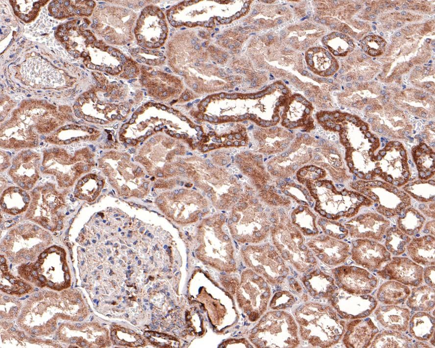 Immunohistochemistry: DTYMK Antibody (JE64-08) [NBP3-32280] - Immunohistochemical analysis of paraffin-embedded human kidney tissue with Rabbit anti-DTYMK antibody (NBP3-32280) at 1/100 dilution. The section was pre-treated using heat mediated antigen retrieval with Tris-EDTA buffer (pH 9.0) for 20 minutes. The tissues were blocked in 1% BSA for 20 minutes at room temperature, washed with ddH2O and PBS, and then probed with the primary antibody (NBP3-32280) at 1/100 dilution for 1 hour at room temperature. The detection was performed using an HRP conjugated compact polymer system. DAB was used as the chromogen. Tissues were counterstained with hematoxylin and mounted with DPX.