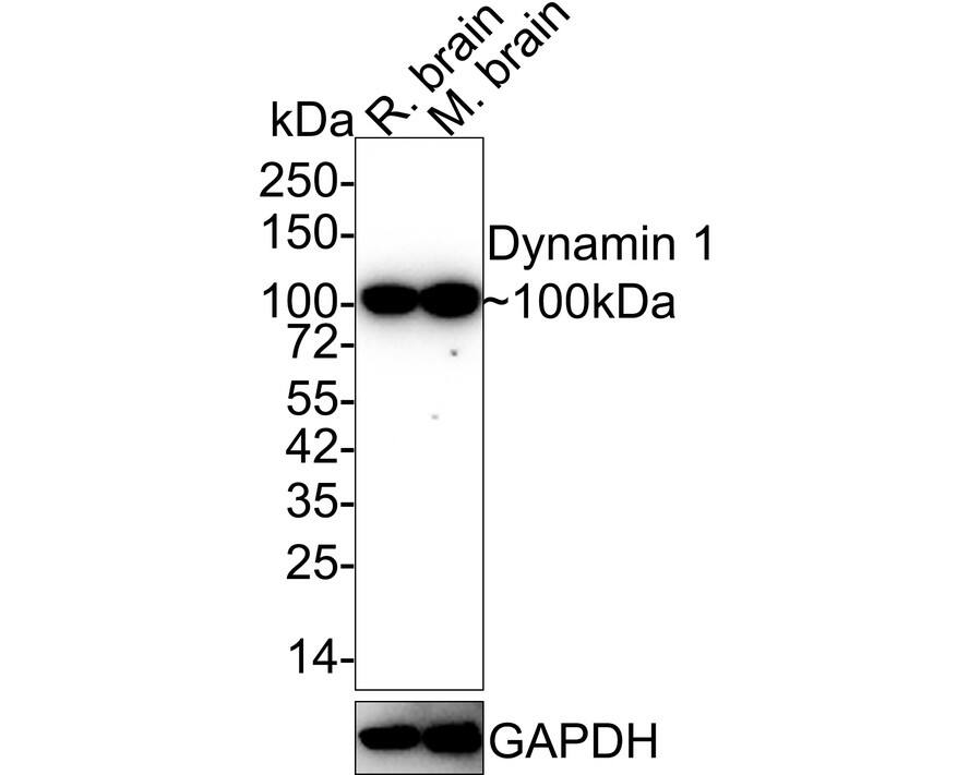 Western blot analysis on different lysates with NBP3-32282 at 1/1,000 dilution. Lane 1: Rat brain tissue lysate Lane 2: Mouse brain tissue lysate Lysates/proteins at 40 µg/Lane. Predicted band size: 97 kDa Observed band size: 100 kDa Exposure time: 3 minutes; 4-20% SDS-PAGE gel. Proteins were transferred to a PVDF membrane and blocked with 5% NFDM/TBST for 1 hour at room temperature. NBP3-32282 at 1/1,000 dilution was used in 5% NFDM/TBST at 4℃ overnight. Goat anti-Mouse IgG [HRP] at 1/50,000 dilution was used for 1 hour at room temperature.