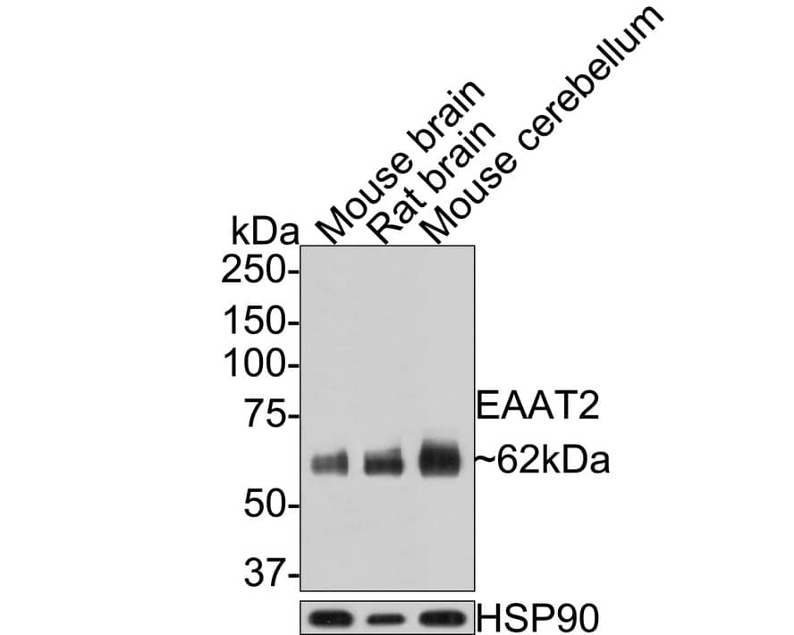 Western Blot: EAAT2/GLT1 Antibody (PS01-62) [NBP3-32287] - Western blot analysis of EAAT2/GLT1 on different lysates with Rabbit anti-EAAT2/GLT1 antibody (NBP3-32287) at 1/1,000 dilution. Lane 1: Mouse brain tissue lysate (20 ug/Lane) Lane 2: Rat brain tissue lysate (20 ug/Lane) Lane 3: Mouse cerebellum tissue lysate (20 ug/Lane) Predicted band size: 62 kDa Observed band size: 62 kDa Exposure time: 2 minutes; 8% SDS-PAGE gel. Proteins were transferred to a PVDF membrane and blocked with 5% NFDM/TBST for 1 hour at room temperature. The primary antibody (NBP3-32287) at 1/1,000 dilution was used in 5% NFDM/TBST at room temperature for 2 hours. Goat Anti-Rabbit IgG - HRP Secondary Antibody at 1:200,000 dilution was used for 1 hour at room temperature.