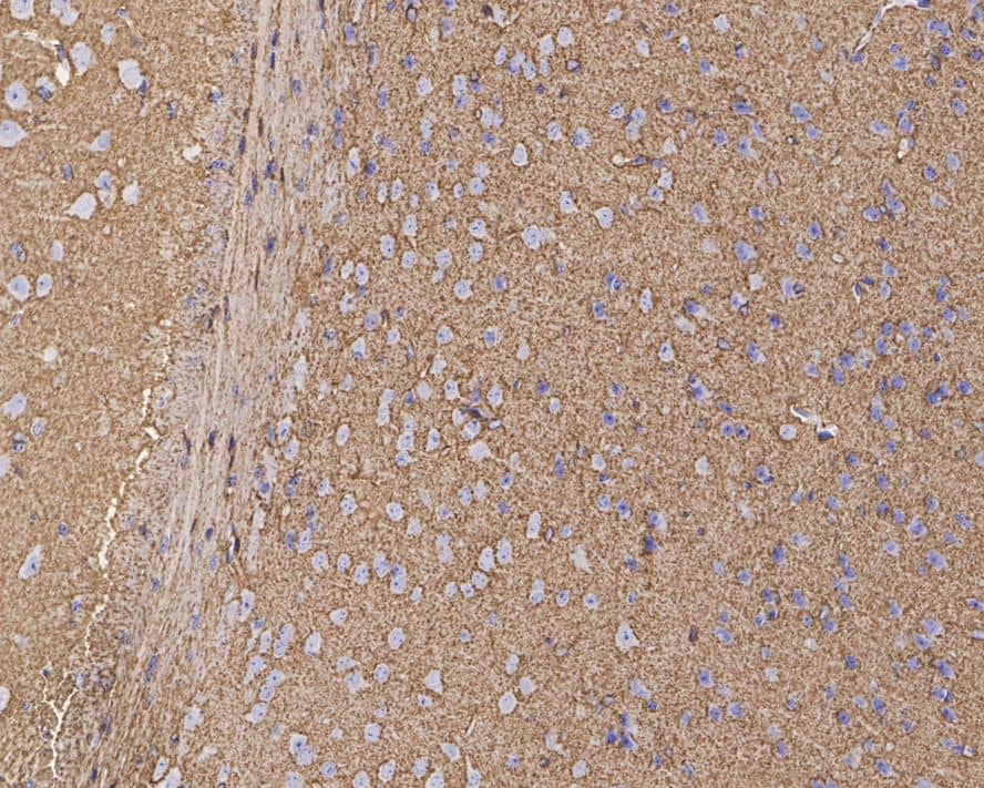 Immunohistochemistry: EAAT2/GLT1 Antibody (PS01-62) [NBP3-32287] - Immunohistochemical analysis of paraffin-embedded mouse brain tissue with Rabbit anti-EAAT2/GLT1 antibody (NBP3-32287) at 1/1,000 dilution. The section was pre-treated using heat mediated antigen retrieval with Tris-EDTA buffer (pH 9.0) for 20 minutes. The tissues were blocked in 1% BSA for 20 minutes at room temperature, washed with ddH2O and PBS, and then probed with the primary antibody (NBP3-32287) at 1/1,000 dilution for 1 hour at room temperature. The detection was performed using an HRP conjugated compact polymer system. DAB was used as the chromogen. Tissues were counterstained with hematoxylin and mounted with DPX.