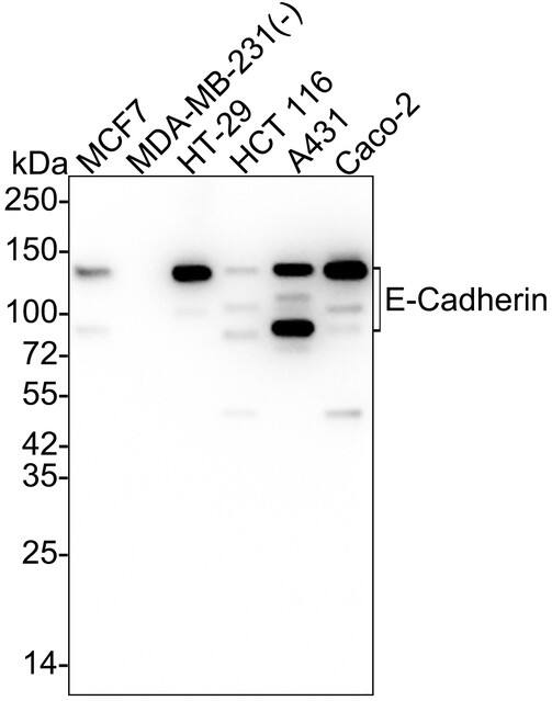 Western blot analysis on different lysates with NBP3-32290 at 1/5,000 dilution and competitor's antibody at 1/1,000 dilution. Lane 1: MCF7 cell lysate Lane 2: MDA-MB-231 cell lysate (negative) Lane 3: HT-29 cell lysate Lane 4: HCT 116 cell lysate Lane 5: A431 cell lysate Lane 6: Caco-2 cell lysate Lysates/proteins at 20 µg/Lane. Predicted band size: 97 kDa Observed band size: 80~120 kDa Exposure time: 43 seconds;  4-20% SDS-PAGE gel. Proteins were transferred to a PVDF membrane and blocked with 5% NFDM/TBST for 1 hour at room temperature. NBP3-32290 at 1/5,000 dilution and competitor's antibody at 1/1,000 dilution were used in 5% NFDM/TBST at 4℃ overnight. Goat Anti-Rabbit IgG [HRP] Secondary Antibody at 1/50,000 dilution was used for 1 hour at room temperature.