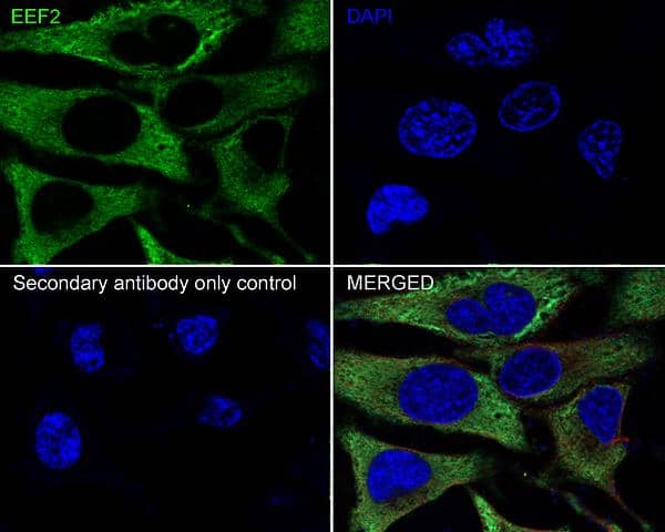 Immunocytochemistry/ Immunofluorescence: eEF-2 Antibody (JE32-57) [NBP3-32293] - Immunocytochemistry analysis of HeLa cells labeling eEF-2 with Rabbit anti-eEF-2 antibody (NBP3-32293) at 1/250 dilution. Cells were fixed in 100% methanol for 10 minutes, permeabilized with 0.1% Triton X-100 in PBS for 15 minutes, and then blocked with 1% BSA for 30 minutes at room temperature. Cells were then incubated with Rabbit anti-eEF-2 antibody (NBP3-32293) at 1/250 dilution in 2% negative goat serum overnight at 4 ℃. Goat Anti-Rabbit IgG H&L (iFluor™ 488) was used as the secondary antibody at 1/1,000 dilution. Nuclear DNA was labelled in blue with DAPI. Beta tubulin (red) was stained at 1/100 dilution overnight at +4℃. Goat Anti-Mouse IgG H&L (iFluor™ 594) was used as the secondary antibody at 1/1,000 dilution.