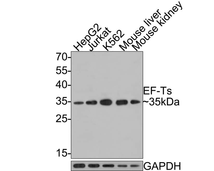 Western Blot: TSFM Antibody (JE64-29) [NBP3-32294] - Western blot analysis of TSFM on different lysates with Rabbit anti-TSFM antibody (NBP3-32294) at 1/500 dilution. Lane 1: HepG2 cell lysate, 10 ug/Lane Lane 2: Jurkat cell lysate, 10 ug/Lane Lane 3: K562 cell lysate, 10 ug/Lane Lane 4: Mouse liver tissue lysate, 20 ug/Lane Lane 5: Mouse kidney tissue lysate, 20 ug/Lane Predicted band size: 35 kDa Observed band size: 35 kDa Exposure time: 1 minute; 12% SDS-PAGE gel. Proteins were transferred to a PVDF membrane and blocked with 5% NFDM/TBST for 1 hour at room temperature. The primary antibody (NBP3-32294) at 1/500 dilution was used in 5% NFDM/TBST at room temperature for 2 hours. Goat Anti-Rabbit IgG - HRP Secondary Antibody at 1:300,000 dilution was used for 1 hour at room temperature.
