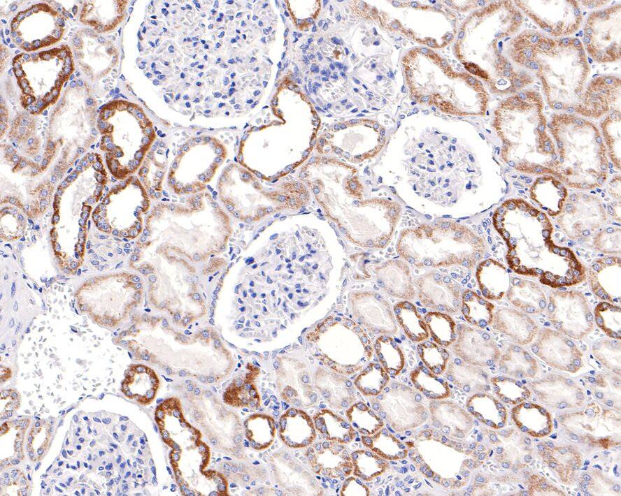 Immunohistochemistry: TSFM Antibody (JE64-29) [NBP3-32294] - Immunohistochemical analysis of paraffin-embedded human kidney tissue with Rabbit anti-TSFM antibody (NBP3-32294) at 1/100 dilution. The section was pre-treated using heat mediated antigen retrieval with Tris-EDTA buffer (pH 9.0) for 20 minutes. The tissues were blocked in 1% BSA for 20 minutes at room temperature, washed with ddH2O and PBS, and then probed with the primary antibody (NBP3-32294) at 1/100 dilution for 1 hour at room temperature. The detection was performed using an HRP conjugated compact polymer system. DAB was used as the chromogen. Tissues were counterstained with hematoxylin and mounted with DPX.