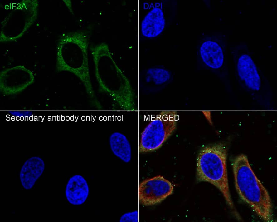 Immunocytochemistry/ Immunofluorescence: EIF3A Antibody (JE58-60) [NBP3-32297] - Immunocytochemistry analysis of Hela cells labeling EIF3A with Rabbit anti-EIF3A antibody (NBP3-32297) at 1/100 dilution. Cells were fixed in 4% paraformaldehyde for 10 minutes at 37 ℃, permeabilized with 0.05% Triton X-100 in PBS for 20 minutes, and then blocked with 2% negative goat serum for 30 minutes at room temperature. Cells were then incubated with Rabbit anti-EIF3A antibody (NBP3-32297) at 1/100 dilution in 2% negative goat serum overnight at 4 ℃. Goat Anti-Rabbit IgG H&L (iFluor™ 488) was used as the secondary antibody at 1/1,000 dilution. Nuclear DNA was labelled in blue with DAPI. Beta tubulin (red) was stained at 1/200 dilution overnight at +4℃. Goat Anti-Mouse IgG H&L (iFluor™ 594) was used as the secondary antibody at 1/1,000 dilution.