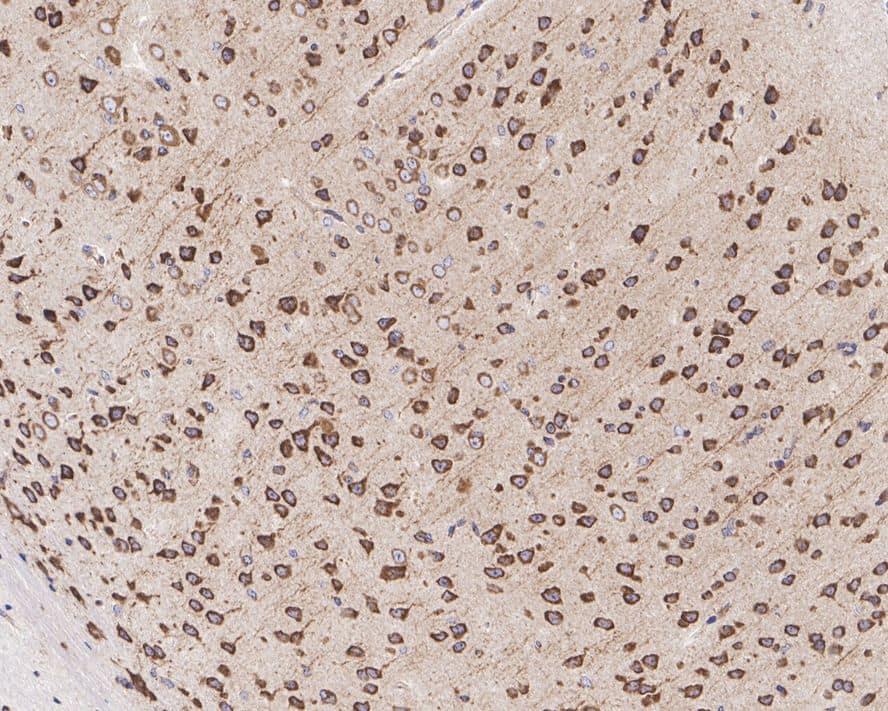 Immunohistochemistry: EIF3A Antibody (JE58-60) [NBP3-32297] - Immunohistochemical analysis of paraffin-embedded mouse brain tissue with Rabbit anti-EIF3A antibody (NBP3-32297) at 1/1,000 dilution. The section was pre-treated using heat mediated antigen retrieval with Tris-EDTA buffer (pH 9.0) for 20 minutes. The tissues were blocked in 1% BSA for 20 minutes at room temperature, washed with ddH2O and PBS, and then probed with the primary antibody (NBP3-32297) at 1/1,000 dilution for 1 hour at room temperature. The detection was performed using an HRP conjugated compact polymer system. DAB was used as the chromogen. Tissues were counterstained with hematoxylin and mounted with DPX.