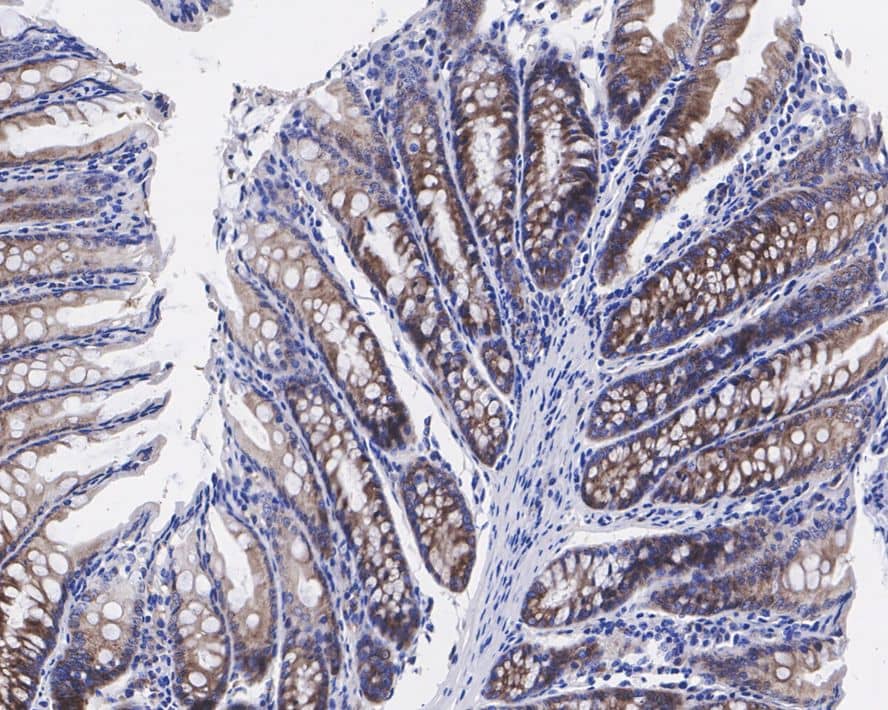 Immunohistochemistry: eIF4A1 Antibody (JE35-43) [NBP3-32299] - Immunohistochemical analysis of paraffin-embedded mouse colon tissue with Rabbit anti-eIF4A1 antibody (NBP3-32299) at 1/200 dilution. The section was pre-treated using heat mediated antigen retrieval with Tris-EDTA buffer (pH 9.0) for 20 minutes. The tissues were blocked in 1% BSA for 20 minutes at room temperature, washed with ddH2O and PBS, and then probed with the primary antibody (NBP3-32299) at 1/200 dilution for 1 hour at room temperature. The detection was performed using an HRP conjugated compact polymer system. DAB was used as the chromogen. Tissues were counterstained with hematoxylin and mounted with DPX.