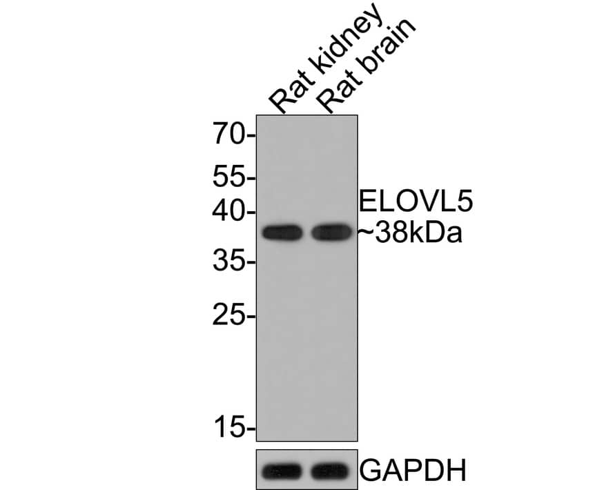 Western Blot: ELOVL5 Antibody (JE65-70) [NBP3-32305] - Western blot analysis of ELOVL5 on different lysates with Rabbit anti-ELOVL5 antibody (NBP3-32305) at 1/500 dilution. Lane 1: Rat kidney tissue lysate Lane 2: Rat brain tissue lysate Lysates/proteins at 20 ug/Lane. Predicted band size: 35 kDa Observed band size: 38 kDa Exposure time: 2 minutes; 12% SDS-PAGE gel. Proteins were transferred to a PVDF membrane and blocked with 5% NFDM/TBST for 1 hour at room temperature. The primary antibody (NBP3-32305) at 1/500 dilution was used in 5% NFDM/TBST at room temperature for 2 hours. Goat Anti-Rabbit IgG - HRP Secondary Antibody at 1:300,000 dilution was used for 1 hour at room temperature.