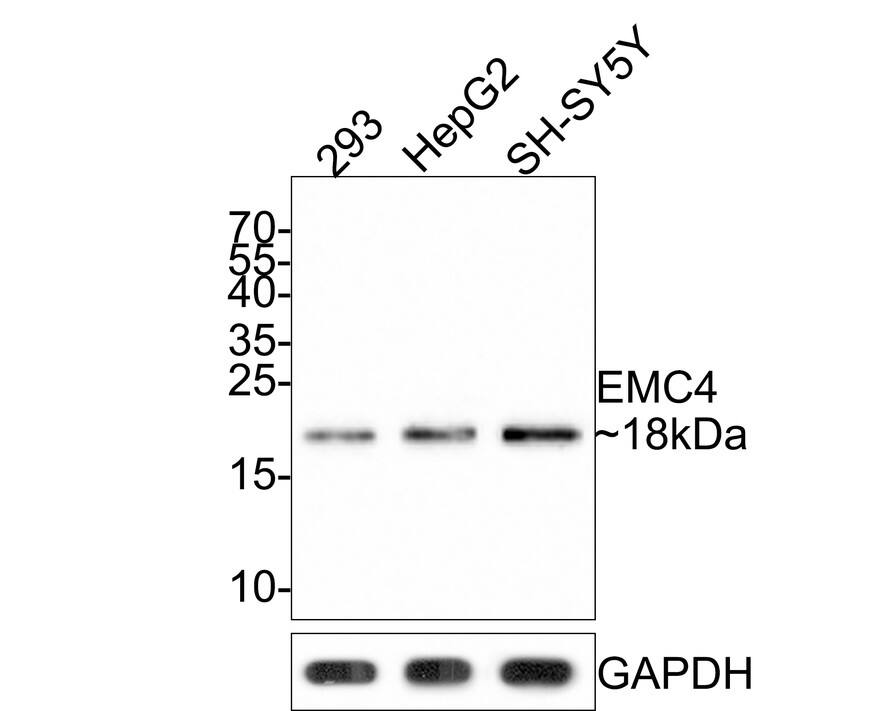 Western Blot: TMEM85 Antibody (JE65-17) [NBP3-32306] - Western blot analysis of TMEM85 on different lysates with Rabbit anti-TMEM85 antibody (NBP3-32306) at 1/500 dilution. Lane 1: 293 cell lysate Lane 2: HepG2 cell lysate Lane 3: SH-SY5Y cell lysate Lysates/proteins at 10 ug/Lane. Predicted band size: 20 kDa Observed band size: 18 kDa Exposure time: 2 minutes; 15% SDS-PAGE gel. Proteins were transferred to a PVDF membrane and blocked with 5% NFDM/TBST for 1 hour at room temperature. The primary antibody (NBP3-32306) at 1/500 dilution was used in 5% NFDM/TBST at room temperature for 2 hours. Goat Anti-Rabbit IgG - HRP Secondary Antibody at 1:300,000 dilution was used for 1 hour at room temperature.
