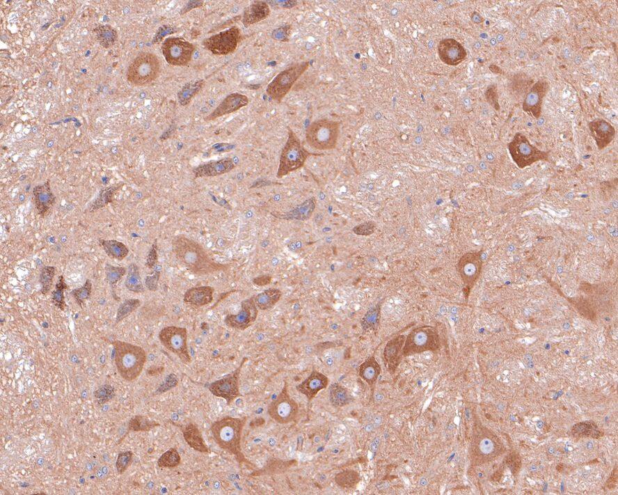 Immunohistochemistry: TMEM85 Antibody (JE65-17) [NBP3-32306] - Immunohistochemical analysis of paraffin-embedded rat brain tissue with Rabbit anti-TMEM85 antibody (NBP3-32306) at 1/400 dilution. The section was pre-treated using heat mediated antigen retrieval with Tris-EDTA buffer (pH 9.0) for 20 minutes. The tissues were blocked in 1% BSA for 20 minutes at room temperature, washed with ddH2O and PBS, and then probed with the primary antibody (NBP3-32306) at 1/400 dilution for 1 hour at room temperature. The detection was performed using an HRP conjugated compact polymer system. DAB was used as the chromogen. Tissues were counterstained with hematoxylin and mounted with DPX.