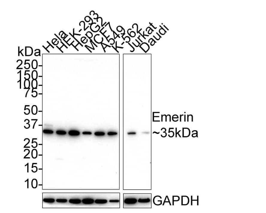 Western Blot: Emerin Antibody (PSH01-85) [NBP3-32307] - Western blot analysis of Emerin on different lysates with Rabbit anti-Emerin antibody (NBP3-32307) at 1/1,000 dilution. Lane 1: HeLa cell lysate Lane 2: HEK-293 cell lysate Lane 3: HepG2 cell lysate Lane 4: MCF7 cell lysate Lane 5: A549 cell lysate Lane 6: K-562 cell lysate Lane 7: Jurkat cell lysate Lane 8: Daudi cell lysate Lysates/proteins at 20 ug/Lane. Predicted band size: 29 kDa Observed band size: 35 kDa Exposure time: 5 minutes; 4-20% SDS-PAGE gel. Proteins were transferred to a PVDF membrane and blocked with 5% NFDM/TBST for 1 hour at room temperature. The primary antibody (NBP3-32307) at 1/1,000 dilution was used in 5% NFDM/TBST at room temperature for 2 hours. Goat Anti-Rabbit IgG - HRP Secondary Antibody at 1/50,000 dilution was used for 1 hour at room temperature.