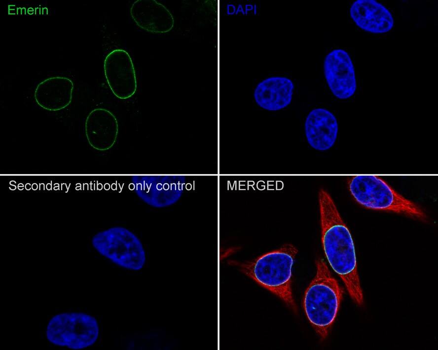 Immunocytochemistry/ Immunofluorescence: Emerin Antibody (PSH01-85) [NBP3-32307] - Immunocytochemistry analysis of HeLa cells labeling Emerin with Rabbit anti-Emerin antibody (NBP3-32307) at 1/100 dilution. Cells were fixed in 4% paraformaldehyde for 20 minutes at room temperature, permeabilized with 0.1% Triton X-100 in PBS for 5 minutes at room temperature, then blocked with 1% BSA in 10% negative goat serum for 1 hour at room temperature. Cells were then incubated with Rabbit anti-Emerin antibody (NBP3-32307) at 1/100 dilution in 1% BSA in PBST overnight at 4 ℃. Goat Anti-Rabbit IgG H&L (iFluor™ 488) was used as the secondary antibody at 1/1,000 dilution. PBS instead of the primary antibody was used as the secondary antibody only control. Nuclear DNA was labelled in blue with DAPI. Beta tubulin (red) was stained at 1/100 dilution overnight at +4℃. Goat Anti-Mouse IgG H&L (iFluor™ 594) was used as the secondary antibody at 1/1,000 dilution.