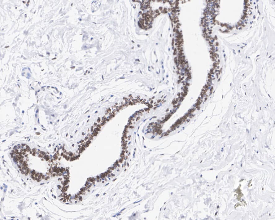 Immunohistochemistry: Emerin Antibody (PSH01-85) [NBP3-32307] - Immunohistochemical analysis of paraffin-embedded human breast tissue with Rabbit anti-Emerin antibody (NBP3-32307) at 1/1,000 dilution. The section was pre-treated using heat mediated antigen retrieval with sodium citrate buffer (pH 6.0) for 2 minutes. The tissues were blocked in 1% BSA for 20 minutes at room temperature, washed with ddH2O and PBS, and then probed with the primary antibody (NBP3-32307) at 1/1,000 dilution for 1 hour at room temperature. The detection was performed using an HRP conjugated compact polymer system. DAB was used as the chromogen. Tissues were counterstained with hematoxylin and mounted with DPX.