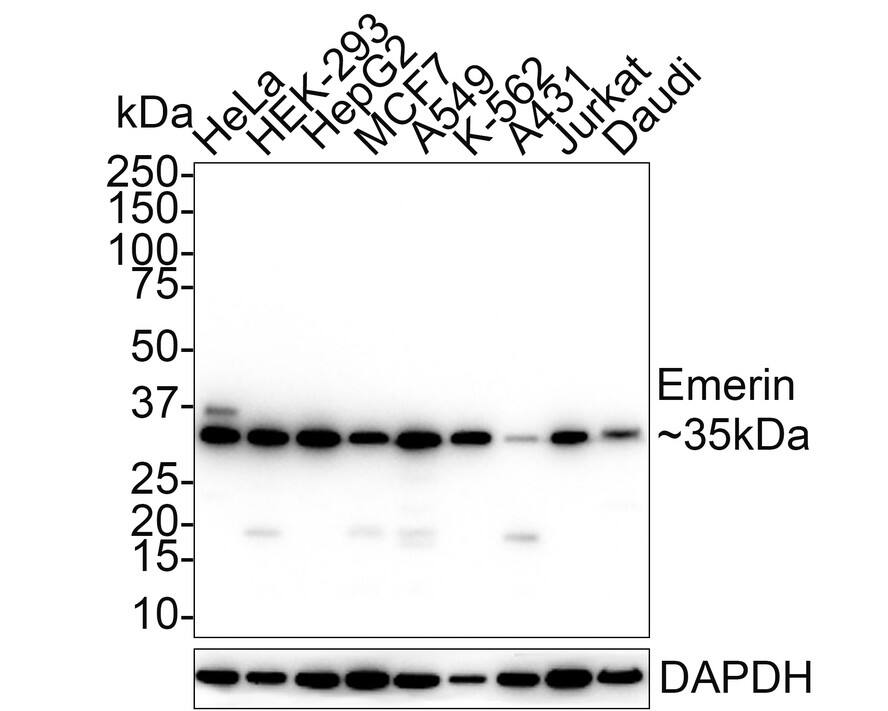 Western blot analysis on different lysates with NBP3-32308 at 1/1,000 dilution. Lane 1: HeLa cell lysate Lane 2: HEK-293 cell lysate Lane 3: HepG2 cell lysate Lane 4: MCF7 cell lysate Lane 5: A549 cell lysate Lane 6: K-562 cell lysate Lane 7: A431 cell lysate Lane 8: Jurkat cell lysate Lane 9: Daudi cell lysate Lysates/proteins at 20 µg/Lane. Predicted band size: 29 kDa Observed band size: 35 kDa Exposure time: 1 minutes 46 seconds; 4-20% SDS-PAGE gel. Proteins were transferred to a PVDF membrane and blocked with 5% NFDM/TBST for 1 hour at room temperature. NBP3-32308 at 1/1,000 dilution was used in 5% NFDM/TBST at room temperature for 2 hours. Goat Anti-Rabbit IgG [HRP] Secondary Antibody at 1/50,000 dilution was used for 1 hour at room temperature.