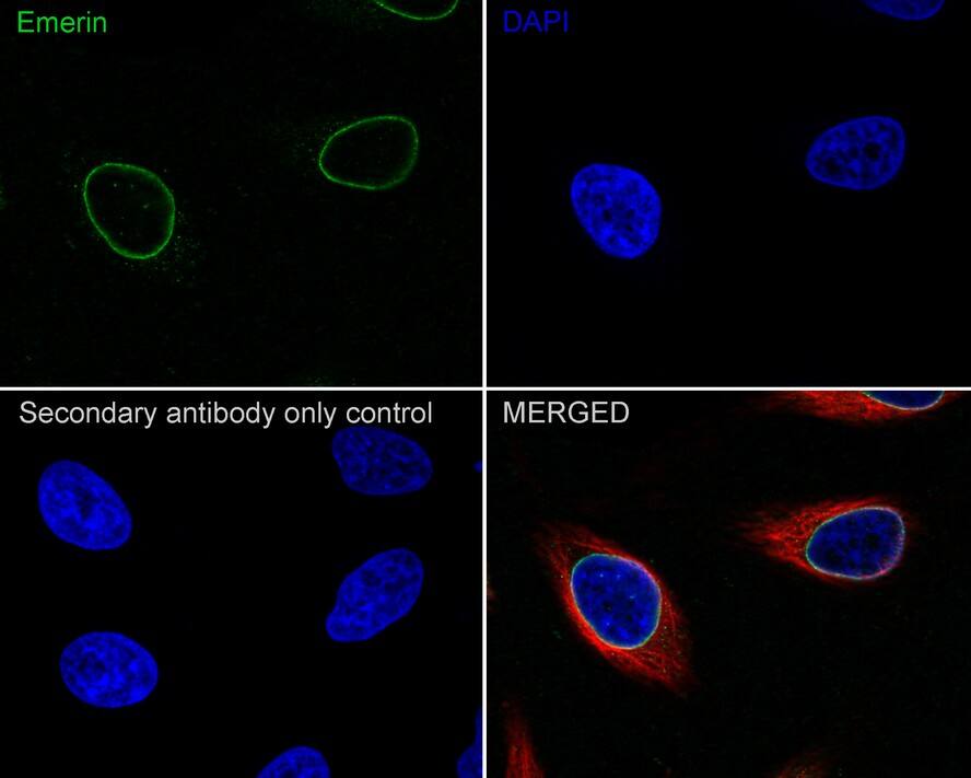 Immunocytochemistry/ Immunofluorescence: Emerin Antibody (PSH01-86) [NBP3-32308] - Immunocytochemistry analysis of HeLa cells labeling Emerin with Rabbit anti-Emerin antibody (NBP3-32308) at 1/100 dilution. Cells were fixed in 4% paraformaldehyde for 20 minutes at room temperature, permeabilized with 0.1% Triton X-100 in PBS for 5 minutes at room temperature, then blocked with 1% BSA in 10% negative goat serum for 1 hour at room temperature. Cells were then incubated with Rabbit anti-Emerin antibody (NBP3-32308) at 1/100 dilution in 1% BSA in PBST overnight at 4 ℃. Goat Anti-Rabbit IgG H&L (iFluor™ 488) was used as the secondary antibody at 1/1,000 dilution. PBS instead of the primary antibody was used as the secondary antibody only control. Nuclear DNA was labelled in blue with DAPI. Beta tubulin (red) was stained at 1/100 dilution overnight at +4℃. Goat Anti-Mouse IgG H&L (iFluor™ 594) was used as the secondary antibody at 1/1,000 dilution.