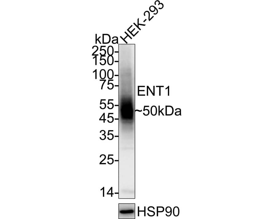 Western Blot ENT1 Antibody (PD00-77)