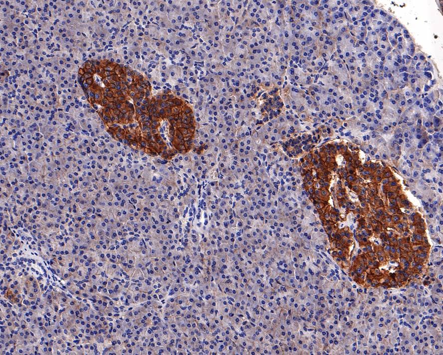 Immunohistochemistry: ENT1 Antibody (PD00-77) [NBP3-32309] - Immunohistochemical analysis of paraffin-embedded human pancreas tissue with Rabbit anti-ENT1 antibody (NBP3-32309) at 1/1,000 dilution. The section was pre-treated using heat mediated antigen retrieval with Tris-EDTA buffer (pH 9.0) for 20 minutes. The tissues were blocked in 1% BSA for 20 minutes at room temperature, washed with ddH2O and PBS, and then probed with the primary antibody (NBP3-32309) at 1/1,000 dilution for 1 hour at room temperature. The detection was performed using an HRP conjugated compact polymer system. DAB was used as the chromogen. Tissues were counterstained with hematoxylin and mounted with DPX.