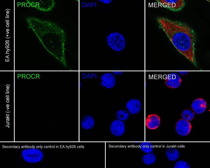 Immunocytochemistry/ Immunofluorescence: EPCR Antibody (PSH03-50) [NBP3-32311] - Immunocytochemistry analysis of EA.hy926 (positive) and Jurkat (negative) labeling EPCR with Rabbit anti-EPCR antibody (NBP3-32311) at 1/100 dilution. Cells were fixed in 100% precooled methanol for 5 minutes at room temperature, then blocked with 1% BSA in 10% negative goat serum for 1 hour at room temperature. Cells were then incubated with Rabbit anti-EPCR antibody (NBP3-32311) at 1/100 dilution in 1% BSA in PBST overnight at 4 ℃. Goat Anti-Rabbit IgG H&L (iFluor™ 488) was used as the secondary antibody at 1/1,000 dilution. PBS instead of the primary antibody was used as the secondary antibody only control. Nuclear DNA was labelled in blue with DAPI. Beta tubulin (red) was stained at 1/100 dilution overnight at +4℃. Goat Anti-Mouse IgG H&L (iFluor™ 594) was used as the secondary antibody at 1/1,000 dilution.