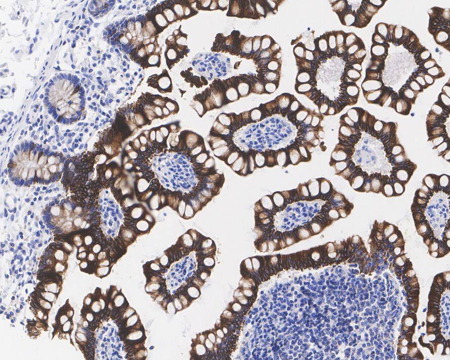 Immunohistochemistry: ErbB3/Her3 Antibody (PD00-44) [NBP3-32313] - Immunohistochemical analysis of paraffin-embedded human small intestine tissue with Rabbit anti-ErbB3/Her3 antibody (NBP3-32313) at 1/2,000 dilution. The section was pre-treated using heat mediated antigen retrieval with Tris-EDTA buffer (pH 9.0) for 20 minutes. The tissues were blocked in 1% BSA for 20 minutes at room temperature, washed with ddH2O and PBS, and then probed with the primary antibody (NBP3-32313) at 1/2,000 dilution for 1 hour at room temperature. The detection was performed using an HRP conjugated compact polymer system. DAB was used as the chromogen. Tissues were counterstained with hematoxylin and mounted with DPX.