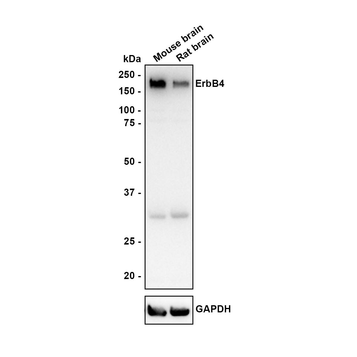 Western blot analysis on different lysates with NBP3-32314 at 1/1,000 dilution. Lane 1: Mouse brain tissue lysate Lane 2: Rat brain tissue lysate Lysates/proteins at 40 µg/Lane. Predicted band size: 147 kDa Observed band size: 180 kDa Exposure time: 5 minutes; 4-20% SDS-PAGE gel. Proteins were transferred to a PVDF membrane and blocked with 5% NFDM/TBST for 1 hour at room temperature. NBP3-32314 at 1/1,000 dilution was used in 5% NFDM/TBST at room temperature for 2 hours. Goat Anti-Rabbit IgG [HRP] Secondary Antibody at 1/100,000 dilution was used for 1 hour at room temperature.
