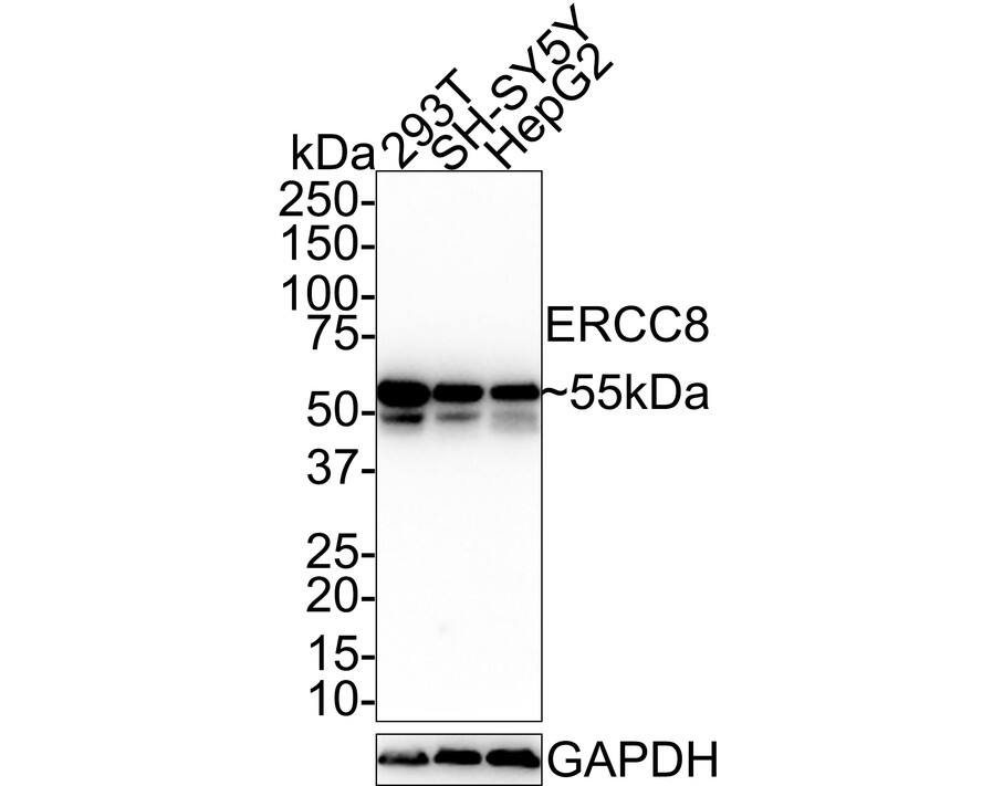 Western Blot: ERCC8 Antibody (PSH0-86) [NBP3-32315] - Western blot analysis of ERCC8 on different lysates with Rabbit anti-ERCC8 antibody (NBP3-32315) at 1/1,000 dilution. Lane 1: 293T cell lysate Lane 2: SH-SY5Y cell lysate Lane 3: HepG2 cell lysate Lysates/proteins at 30 ug/Lane. Predicted band size: 44 kDa Observed band size: 55 kDa Exposure time: 27 seconds; 4-20% SDS-PAGE gel. Proteins were transferred to a PVDF membrane and blocked with 5% NFDM/TBST for 1 hour at room temperature. The primary antibody (NBP3-32315) at 1/1,000 dilution was used in 5% NFDM/TBST at 4C overnight. Goat Anti-Rabbit IgG - HRP Secondary Antibody at 1:100,000 dilution was used for 1 hour at room temperature.