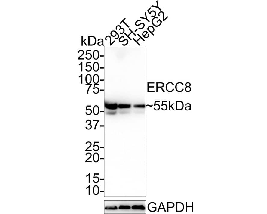 Western Blot: ERCC8 Antibody (PSH0-87) [NBP3-32316] - Western blot analysis of ERCC8 on different lysates with Rabbit anti-ERCC8 antibody (NBP3-32316) at 1/1,000 dilution. Lane 1: 293T cell lysate Lane 2: SH-SY5Y cell lysate Lane 3: HepG2 cell lysate Lysates/proteins at 30 ug/Lane. Predicted band size: 44 kDa Observed band size: 55 kDa Exposure time: 1 minute 32 seconds; 4-20% SDS-PAGE gel. Proteins were transferred to a PVDF membrane and blocked with 5% NFDM/TBST for 1 hour at room temperature. The primary antibody (NBP3-32316) at 1/1,000 dilution was used in 5% NFDM/TBST at 4C overnight. Goat Anti-Rabbit IgG - HRP Secondary Antibody at 1:100,000 dilution was used for 1 hour at room temperature.