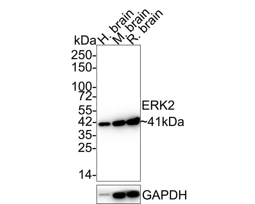 Western blot analysis on different lysates with NBP3-32317 at 1/1,000 dilution. Lane 1: Human brain tissue lysate (40 µg/Lane) Lane 2: Mouse brain tissue lysate (40 µg/Lane) Lane 3: Rat brain tissue lysate (40 µg/Lane) Predicted band size: 41 kDa Observed band size: 41 kDa Exposure time: 1 minute 2 seconds; 4-20% SDS-PAGE gel. Proteins were transferred to a PVDF membrane and blocked with 5% NFDM/TBST for 1 hour at room temperature. NBP3-32317 at 1/1,000 dilution was used in 5% NFDM/TBST at 4℃ overnight. Alpaca Anti-Mouse IgG [HRP] Secondary Antibody at 1/5,000 dilution was used for 1 hour at room temperature.