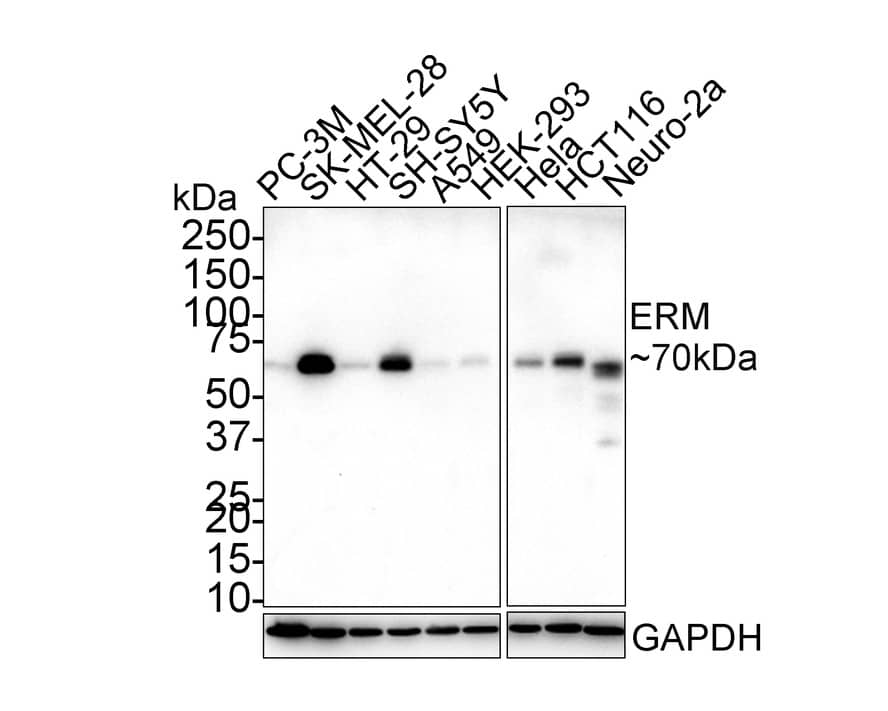 Western Blot: ETV5/ERM Antibody (PSH02-64) [NBP3-32318] - Western blot analysis of ETV5/ERM on different lysates with Rabbit anti-ETV5/ERM antibody (NBP3-32318) at 1/1,000 dilution. Lane 1: PC-3M cell lysate Lane 2: SK-MEL-28 cell lysate Lane 3: HT-29 cell lysate Lane 4: SH-SY5Y cell lysate Lane 5: A549 cell lysate Lane 6: HEK-293 cell lysate Lane 7: Hela cell lysate Lane 8: HCT116 cell lysate Lane 9: Neuro-2a cell lysate Lysates/proteins at 30 ug/Lane. Predicted band size: 58 kDa Observed band size: 70 kDa Exposure time: 5 minutes; 4-20% SDS-PAGE gel. Proteins were transferred to a PVDF membrane and blocked with 5% NFDM/TBST for 1 hour at room temperature. The primary antibody (NBP3-32318) at 1/1,000 dilution was used in 5% NFDM/TBST at 4C overnight. Goat Anti-Rabbit IgG - HRP Secondary Antibody at 1/50,000 dilution was used for 1 hour at room temperature.