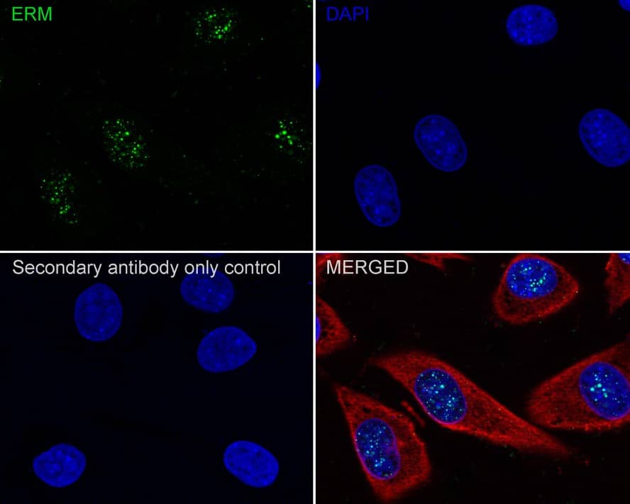 Immunocytochemistry/ Immunofluorescence: ETV5/ERM Antibody (PSH02-64) [NBP3-32318] - Immunocytochemistry analysis of SK-MEL-28 cells labeling ETV5/ERM with Rabbit anti-ETV5/ERM antibody (NBP3-32318) at 1/100 dilution. Cells were fixed in 4% paraformaldehyde for 20 minutes at room temperature, permeabilized with 0.1% Triton X-100 in PBS for 5 minutes at room temperature, then blocked with 1% BSA in 10% negative goat serum for 1 hour at room temperature. Cells were then incubated with Rabbit anti-ETV5/ERM antibody (NBP3-32318) at 1/100 dilution in 1% BSA in PBST overnight at 4 ℃. Goat Anti-Rabbit IgG H&L (iFluor™ 488) was used as the secondary antibody at 1/1,000 dilution. PBS instead of the primary antibody was used as the secondary antibody only control. Nuclear DNA was labelled in blue with DAPI. Beta tubulin (red) was stained at 1/100 dilution overnight at +4℃. Goat Anti-Mouse IgG H&L (iFluor™ 594) was used as the secondary antibody at 1/1,000 dilution.