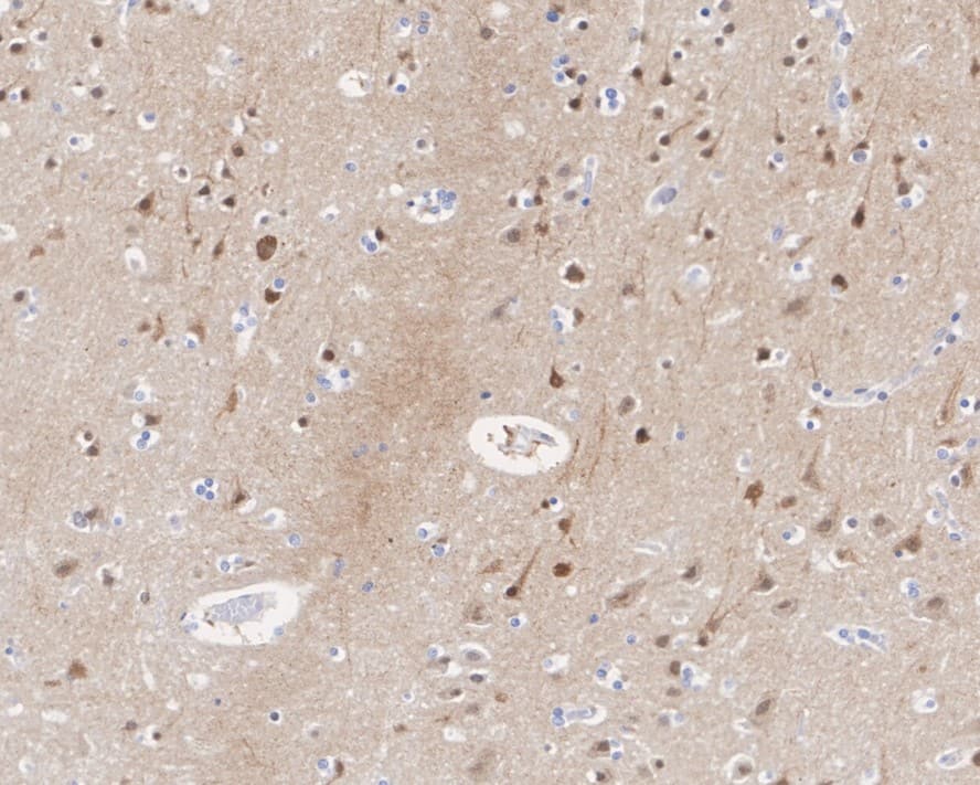 Immunohistochemistry: ETV5/ERM Antibody (PSH02-64) [NBP3-32318] - Immunohistochemical analysis of paraffin-embedded human brain tissue with Rabbit anti-ETV5/ERM antibody (NBP3-32318) at 1/1,000 dilution. The section was pre-treated using heat mediated antigen retrieval with sodium citrate buffer (pH 6.0) for 2 minutes. The tissues were blocked in 1% BSA for 20 minutes at room temperature, washed with ddH2O and PBS, and then probed with the primary antibody (NBP3-32318) at 1/1,000 dilution for 1 hour at room temperature. The detection was performed using an HRP conjugated compact polymer system. DAB was used as the chromogen. Tissues were counterstained with hematoxylin and mounted with DPX.