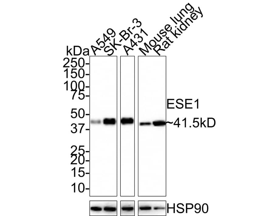 Western Blot: ELF3/ESE-1 Antibody (JE33-30) [NBP3-32320] - Western blot analysis of ELF3/ESE-1 on different lysates with Rabbit anti-ELF3/ESE-1 antibody (NBP3-32320) at 1/1,000 dilution. Lane 1: A549 cell lysate (10 ug/Lane) Lane 2: SK-Br-3 cell lysate (10 ug/Lane) Lane 3: A431 cell lysate (10 ug/Lane) Lane 4: Mouse lung tissue lysate (20 ug/Lane) Lane 5: Rat kidney tissue lysate (20 ug/Lane) Predicted band size: 41.5 kDa Observed band size: 41.5 kDa Exposure time: 40 seconds; 4-20% SDS-PAGE gel. Proteins were transferred to a PVDF membrane and blocked with 5% NFDM/TBST for 1 hour at room temperature. The primary antibody (NBP3-32320) at 1/1,000 dilution was used in 5% NFDM/TBST at room temperature for 2 hours. Goat Anti-Rabbit IgG - HRP Secondary Antibody at 1:100,000 dilution was used for 1 hour at room temperature.