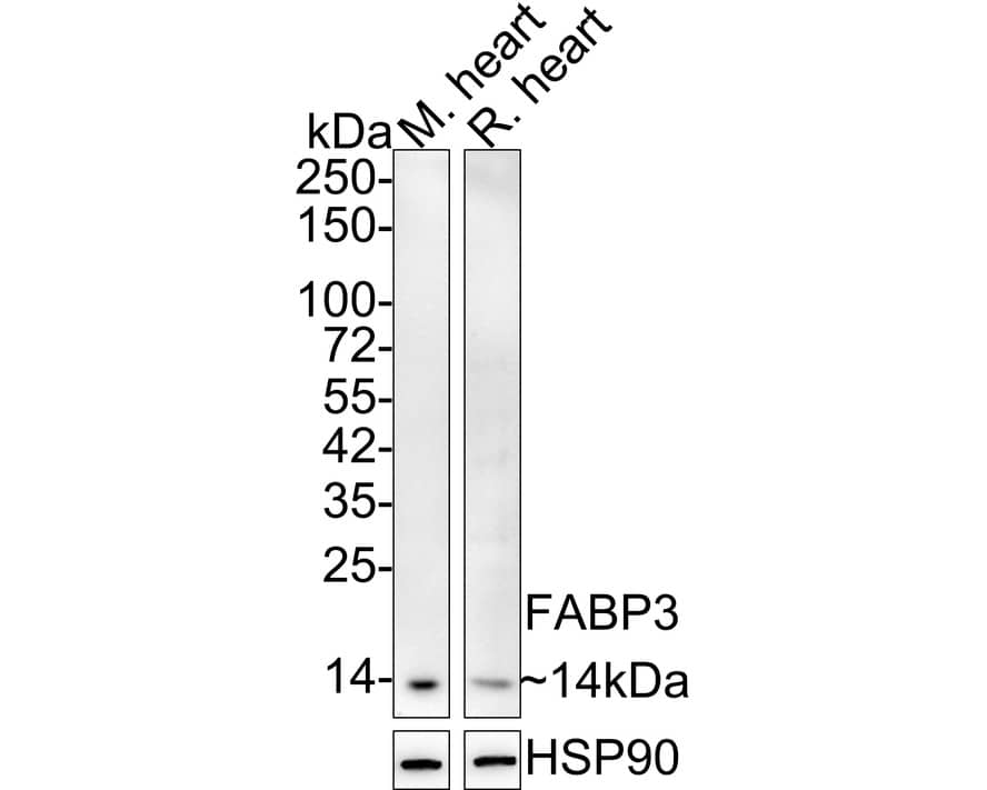 Western Blot: FABP3/H-FABP Antibody (JE53-37) [NBP3-32325] - Western blot analysis of FABP3/H-FABP on different lysates with Rabbit anti-FABP3/H-FABP antibody (NBP3-32325) at 1/2,000 dilution. Lane 1: Mouse heart tissue lysate Lane 2: Rat heart tissue lysate Lysates/proteins at 30 ug/Lane. Predicted band size: 14 kDa Observed band size: 14 kDa Exposure time: 3 minutes; 4-20% SDS-PAGE gel. Proteins were transferred to a PVDF membrane and blocked with 5% NFDM/TBST for 1 hour at room temperature. The primary antibody (NBP3-32325) at 1/2,000 dilution was used in 5% NFDM/TBST at 4C overnight. Goat Anti-Rabbit IgG - HRP Secondary Antibody at 1/50,000 dilution was used for 1 hour at room temperature.