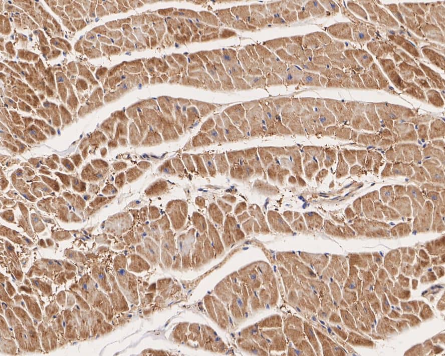 Immunohistochemistry: FABP3/H-FABP Antibody (JE53-37) [NBP3-32325] - Immunohistochemical analysis of paraffin-embedded human heart tissue with Rabbit anti-FABP3/H-FABP antibody (NBP3-32325) at 1/100 dilution. The section was pre-treated using heat mediated antigen retrieval with Tris-EDTA buffer (pH 9.0) for 20 minutes. The tissues were blocked in 1% BSA for 20 minutes at room temperature, washed with ddH2O and PBS, and then probed with the primary antibody (NBP3-32325) at 1/100 dilution for 1 hour at room temperature. The detection was performed using an HRP conjugated compact polymer system. DAB was used as the chromogen. Tissues were counterstained with hematoxylin and mounted with DPX.